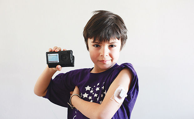 Continuous Glucose Monitoring The Fight for Coverage