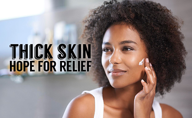 Thick Skin Hope For Relief